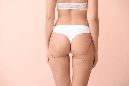 Módulo Post Operatorio — CENESTETICA